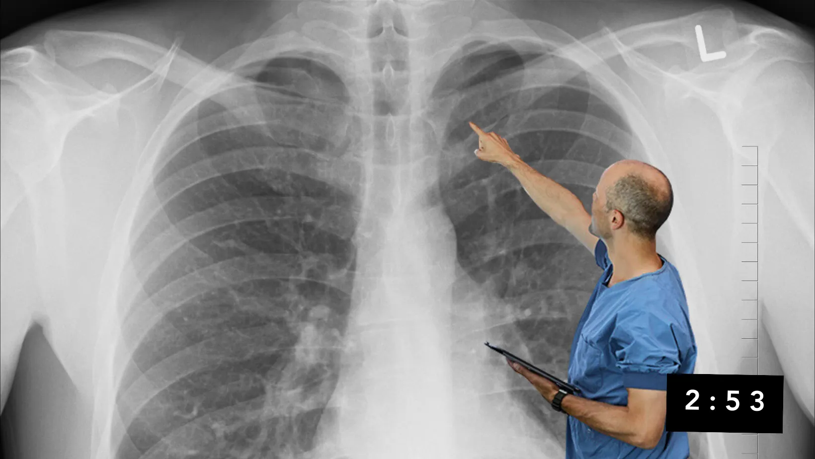 breathLP4I1 breathLP4I1